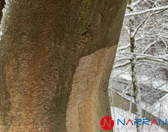 Laser cleaning sandstone statue